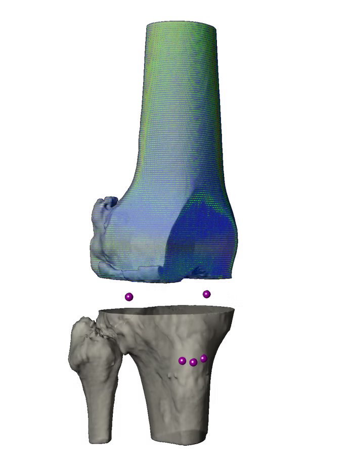 Segmentation, Landmarking, and Surgical Planning for informed review